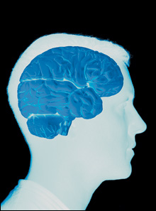 bipolar disorder