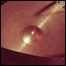 080530_bowedmetal_list