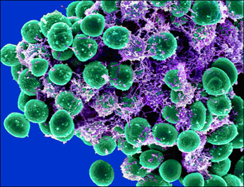 bacteria-Inside.jpg